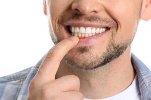 everything you need to know about gum disease 63f3d6c40ef55