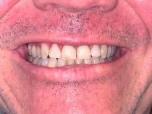 IMG 1014
