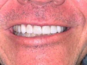 IMG 1015