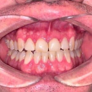 IMG 1016 sq
