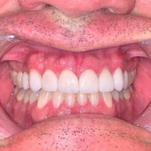 IMG 1017 sq