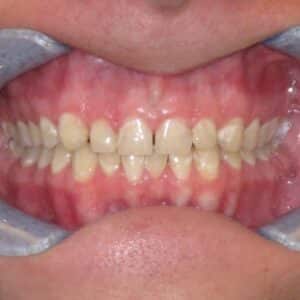 IMG 5385 sq