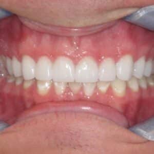IMG 5386 sq